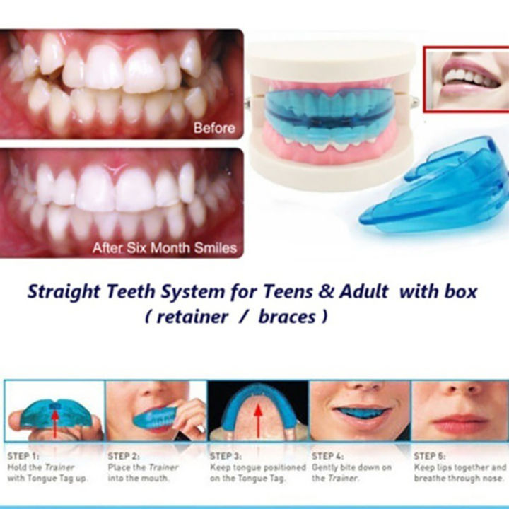 Tooth%20Orthodontic%20Braces%20Appliance%20Silicone%20Alignment%20Trainer%20Teeth%20Retainer%20finpae%20-%20Image%204