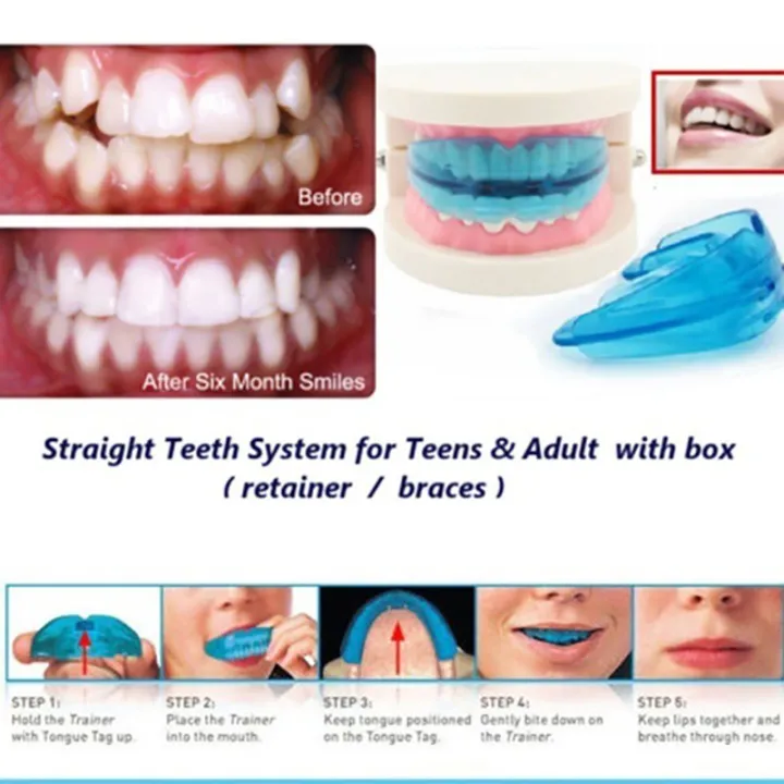 Tooth%20Orthodontic%20Braces%20Appliance%20Silicone%20Alignment%20Trainer%20Teeth%20Retainer%20finpae%20-%20Image%204