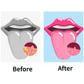 Tongue Scraper and Coating Cleaning Gel Fresh Remove Odor To Cleaner for Bad Breath Cleaning Products for Tongue Cleaning.