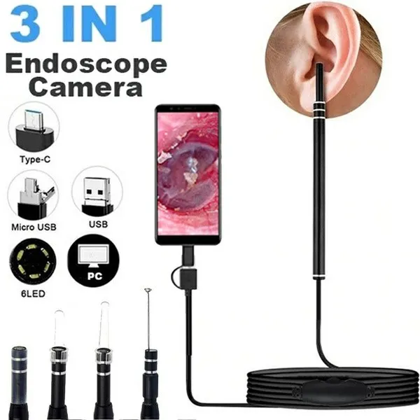 USB%20Otoscope-Ear%20Endoscope%20Diameter%20Visu%20Waterproof%20HD%20Ear%20Camera%20with%20Ear%20Tool%20and%206%20Adjustable%20LED%20Lights%20for%20-Android%20and%20Windows%20-%20Image%204