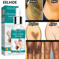 EELHOE Makes Brighter To Your Body And Posture Without Any Side Effect. 