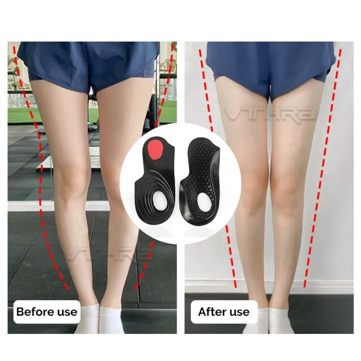 VTHRA%20X/O%20Legs%20Varus%20Orthotic%20Insert%20Insole%20Flat%20Feet%20Insoles%20Plantar%20Fasciitis%20Arch%20Support%20Heel%20Cushion%20Foot%20Gel%20Pad%20Man%20Women%20-%20Image%202