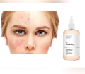 The Ordinary Glycolic Acid 7% Toning Solution. 