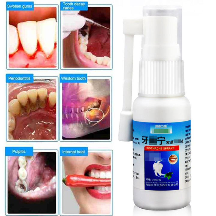 （NEW）Toothache Pain Relief Teeth Care Sprays Effective  Tooth Pain Prevent Oral