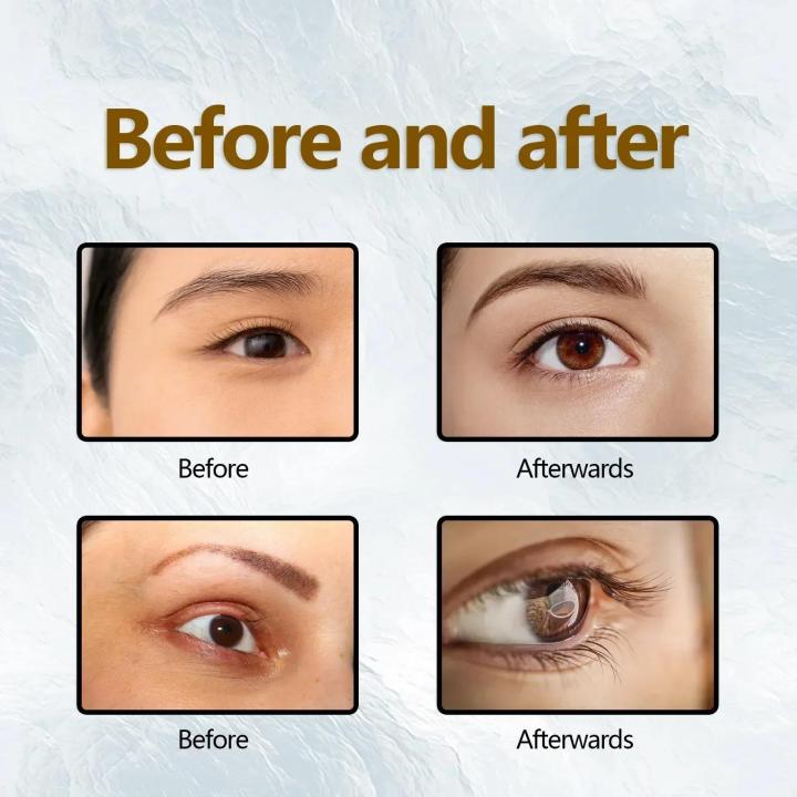 Eyelash%20Growth%20Serum%20Natural%20Lengthening%20Thicken%20Eyelashes%20Eyebrow%20Curl%20Enlarge%20Eyes%20Lash%20Lifting%20Moisturizing%20Nourishing%20Liquid%20-%20Image%202
