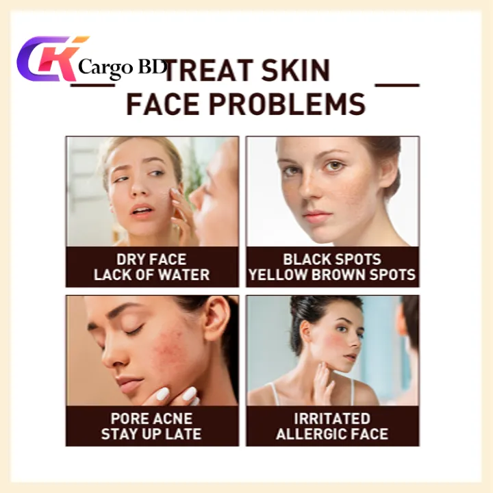 ROREC%20White%20Rice%20Serum%20Best%20For%20Pores%20&%20Moisturizing%20-%2015ml%20-%20Image%207