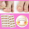 Ingrown Toenail Corrector Stickers Paronychia Treatment Pedicure Toe Nail Care Corrector Patch Correction Stickers 10-50Pcs. 