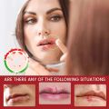 20g Cold Sores Lip Care Cream Repair Cheilitis Lips Herpes Ulceration Antibacterial Ointment Moisturizing Lip Balm. 