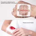 (NEW)2pcs Zip Tie Wound Closure Patch Band-Aid Hemostatic Adhesive Aid Emergency Kit Lets You Close Wounds Without Stitches.