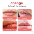 Lip Black Removal Lip Balm Eliminates Uneven Dark Spots on the Lips Treatment. 