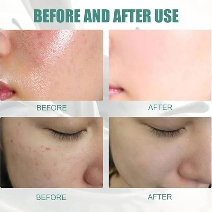 Skinferm%20Collagen%20Milk%20Whitening%20Soap,%20Silk%20Protein%20Whitening%20Soap,%20Skin%20Whitening%20Soap%20for%20Body%20and%20Facial%20Skin%20-%20Image%204