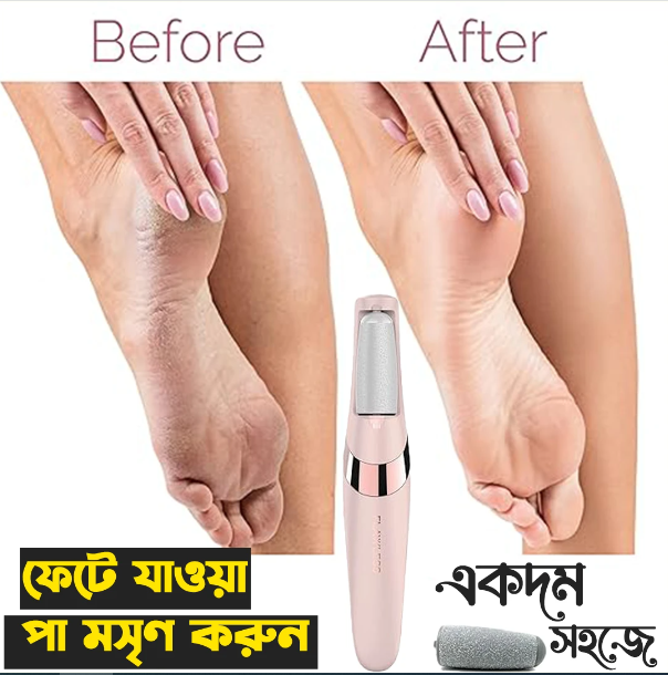 Update%20Model%20Scholl%20Velvet%20Smooth%20Electronic%20Foot%20Cleaner%20(Pedi%20Spin)%20-%20Image%207