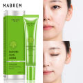 Danshen Acne Cream Acne Removal Fades Acne Marks Repair Damaged Skin Gentle Non-Irritant Skin Rejuvenating Nourishing Skin Care. 