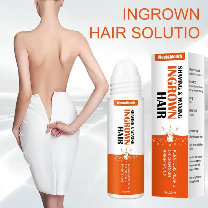 Ingrown%20hair%20after%20shaving%20treatment%20for%20dark%20spots%20repair%20serum%20M2Z1%20-%20Image%205