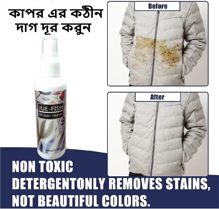 Clothes%20Oil%20Stains%20Remover,%20Nml%20Stain%20Remover,%20Garment%20Stubborn%20Stain%20Cleaner,%20Stain%20Remover%20for%20Clothes,%20Emergency%20Stain%20Rescue%20Stain%20Remover,%20Strong%20Fabric%20Stain%20Remover%20for%20Home%20Use%20-%20100ML%20-%20Image%207