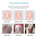 Ingrown Toenail Corrector Tools Pedicure Recover Embed Toe Nail Professional Ingrown Toenail Correction Foot Care Tool. 