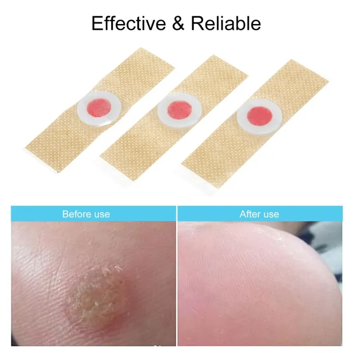 24PCS%20Corn%20Remover%20Pads%20Remover%20Foot%20Pads%20Corn%20Callus%20Remover%20Cushions%20Corn%20Plaster%20with%20Hole%20Corn%20Treatment%20for%20Foot%20Care%20-%20Image%203