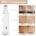 Ultrasonic Skin Scrubber Pore Cleaner 2+4 Kit Facial Ion Shovel Deep Face Cleaning Sonic Peeling Device Kit Blackhead Remover. 