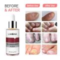 LANBENA Nail Repair Essence Serum - 12ml. 