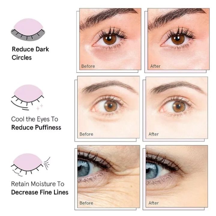 3D%20Electric%20Eye%20Massager%20Intelligent%20Vibration%20Micro-current%20Pulse%20Infrared%20Thermal%20Compression%20To%20Eliminate%20Dark%20Circles%20Beauty%20-%20Image%202