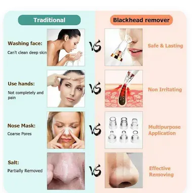 Remove Acne Instrument Multifunctional Cleaning Instrument, Electric Blackhead Remover Machine ...