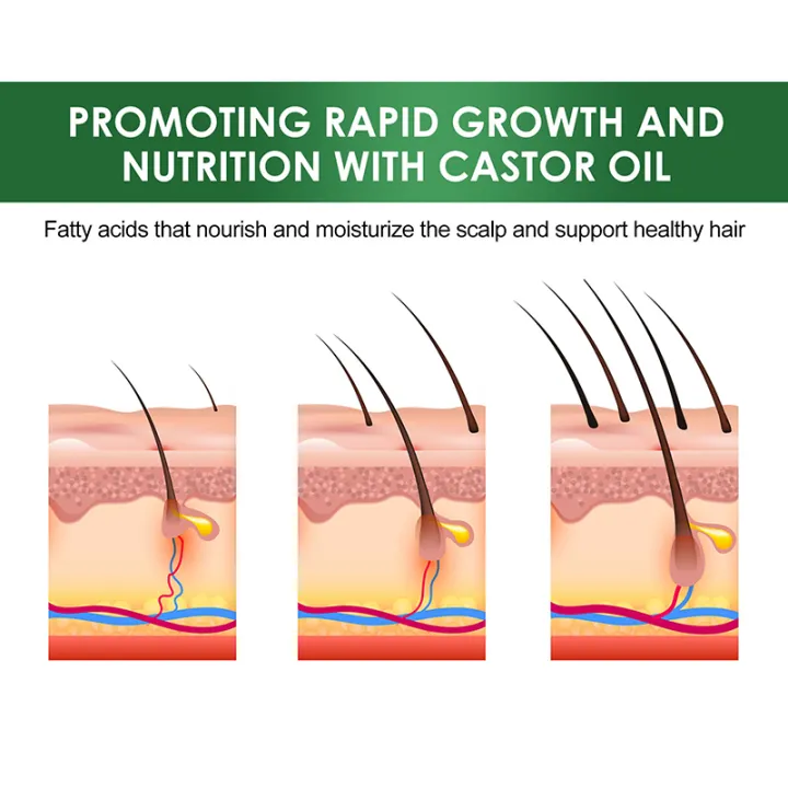 Organic%20Black%20Castor%20Oil%20for%20Hair%20Growth%20Jamaican%20Scalp%20Dense%20Hair%20Strengthening%20Hair%20Loss%20Prevention%20Repair%20Nourishing%20Liquid%20FeeoiF%20-%20Image%205