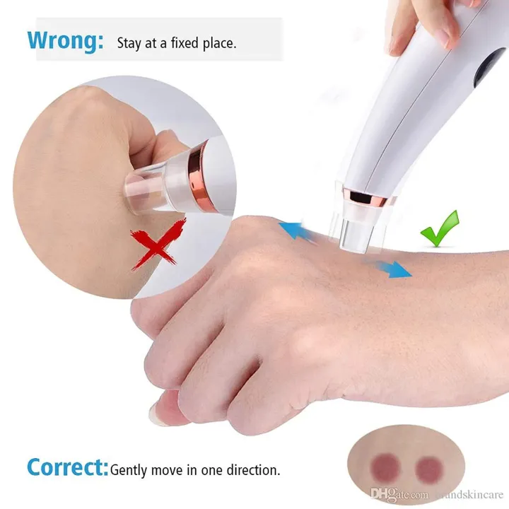 Multi-function%20Blackhead%20Remover%20and%20Whitehead%20Remover%20Device%20-%20Acne%20Pimple%20Pore%20Cleaner%20Vacuum%20Suction%20Tool%20for%20Men%20and%20Women%20Gently%20pull%20dirt%20and%20oil%20out%20of%20your%20skin%20-%20Image%206