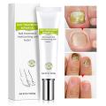 Nail Treatment Repair Gel For Fungal. 