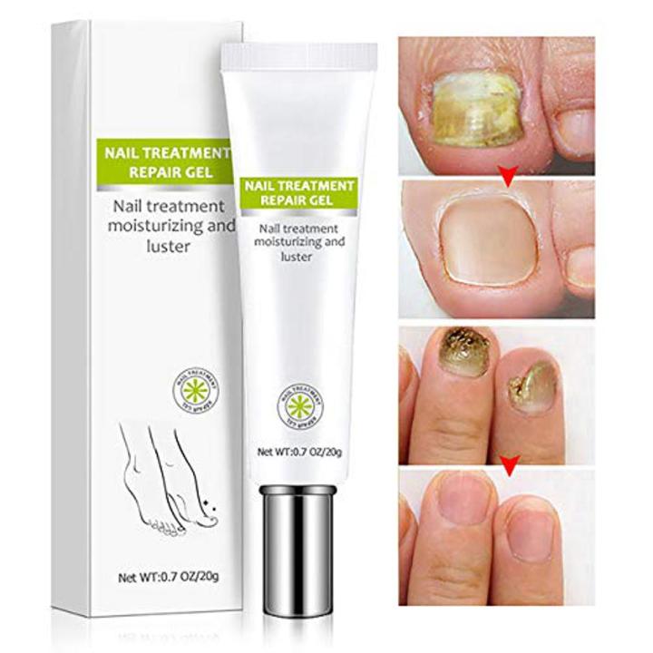 Nail Treatment Repair Gel For Fungal