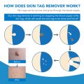 Skin Tag Removal Kit Home Mole Wart Puntos Negros Remover Equipment Micro Skin Tag Removeal Tool Easy To Clean Skin Care Tool.