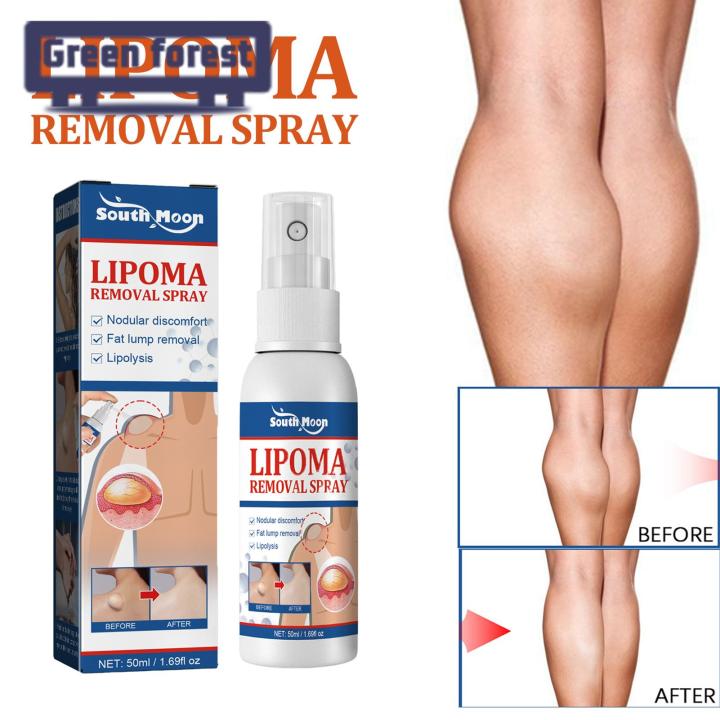 %E3%80%90The%20Edge%20of%20Beauty%E3%80%91foret%20Lump%20Removal%20pray%20Effective%20Fatty%20Lump%20Treatment%20Removal%20pray%20-%20Image%206