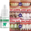ELHOE Teeth Whitening Drops – 100% Natural Herbal Formula – Instantly Whitens Yellow Teeth, Removes Stains, Fights Bad Breath & Plaque – Strengthens Gums & Enamel – Safe for Sensitive Teeth – Fluoride-Free Liquid Oral Care for Men & Women.