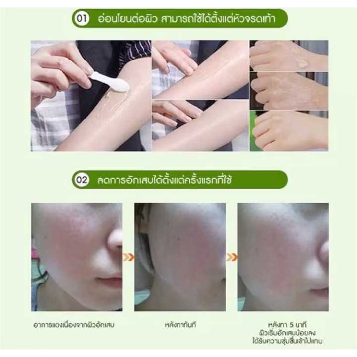 Skin%20Cafe%20Pure%20&%20Natural%20Aloe%20Vera%20gel%2092%25%20-%20Image%205