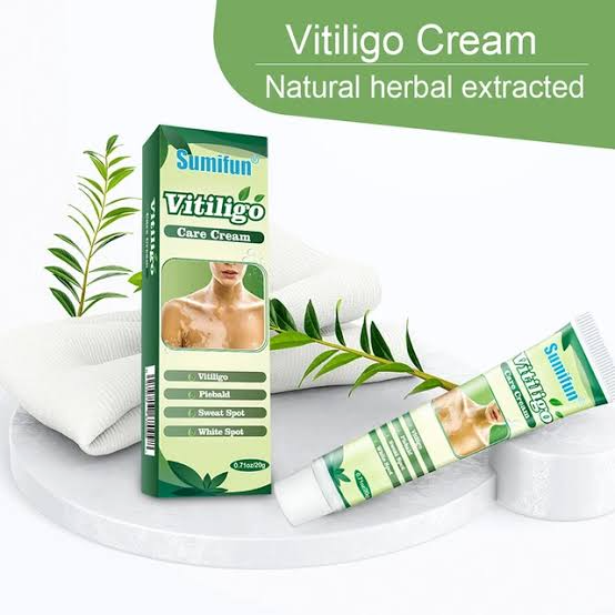 Sumifun%20Vitiligo%20White%20Spot%20Treatment%20Moisturizing%20Cream%20for%20Vitiligo%20-%20Image%203