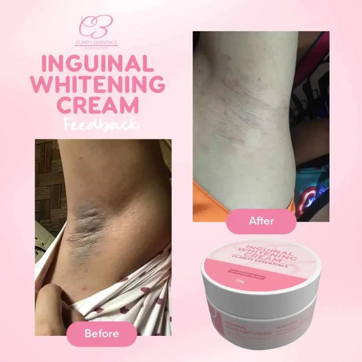Underarm%20Whitening%20Brightening%20Cream%20Body%20Brightening%20removing%20melanin%20without%20rebound%20Inguinal%20Whitening%20Cream%2025g.%20-%20Image%204