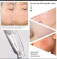 Salicylic Acid 2% Solution (30ml).