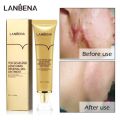 Lanbena - TCM Scar and Acne Mark Removal Gel Ointment - 30gm. 