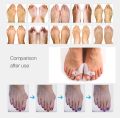 Big Toe Straightener Thumb Valgus Protector Silicone Gel Foot Fingers Toe Separator Bunion Adjuster Feet Pads Relief Foot Pain.