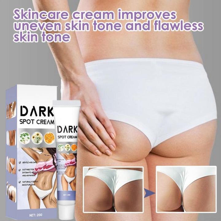 Inner%20Thigh%20Lightening%20Cream%20Black%20Spot%20Remover%20for%20Inner%20Thighs%20and%20Armpits%20Intimate%20Area%20Black%20Armpit%20and%20Spot%20Remover%2020g%20-%20Image%203