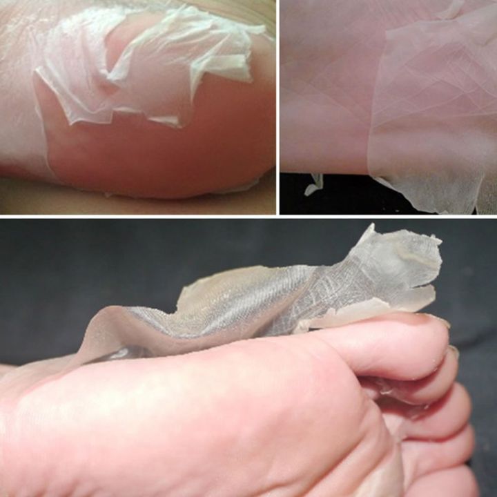 %E3%80%90The%20Edge%20of%20Beauty%E3%80%912pcs%20Exfoliating%20Foot%20Pedicure%20Socks%20Feet%20Mask%20Remove%20Dead%20-%20Image%208