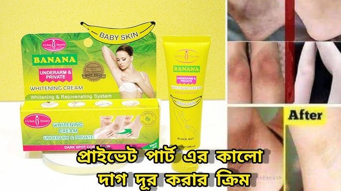 Aichun%20Beauty%20Banana%20Underarm%20and%20Private%20Whitening%20Cream%20-%20Image%202