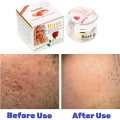 Feique Rose Essence Anti-freck Day and Night Cream. 