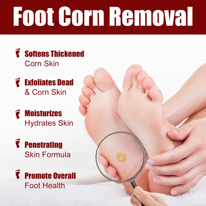 South%20Moon%20Foot%20Corns%20Exfoliating%20Gel%20Hand%20and%20Foot%20Wart%20Thorn%20Calluses%20Skin%20Smooth%20Repair%20and%20Cleaning%20-%20Image%202