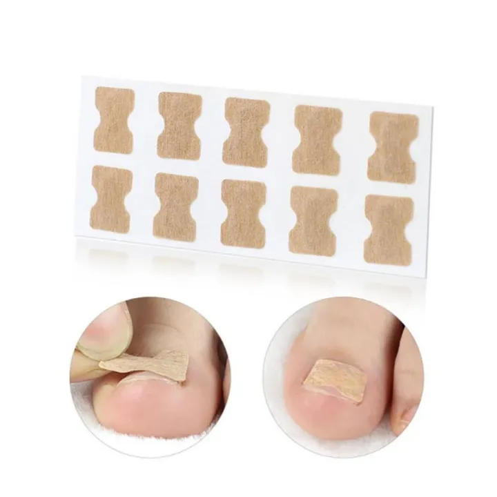 Pexmen%2010/20/Ingrown%20Toenail%20Correction%20Stickers%20Toenail%20Corrector%20Patch%20Big%20Toe%20Nail%20Corrector%20Patch%20-%20Image%203