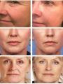 Pore Shrinking Serum Face Removing Large Pores Tightening Repairing Large Pores Facial Pore Minimizing Cream.