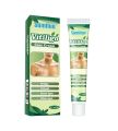 Sumifun Vitiligo Cream Reduces White Spots and Improves Skin Pigmentation 20gm.
