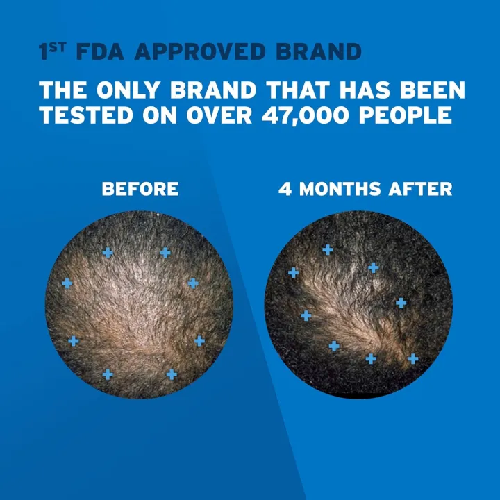 Rogaine%20minoxidil%20foam%205%25%20(one%20month%20supply)(no%20box)%20-%20Image%204