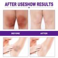 Whitening cream Private Parts Underarm Brighten Inner Thigh Intimate Parts Dark Remove Beauty Health. 