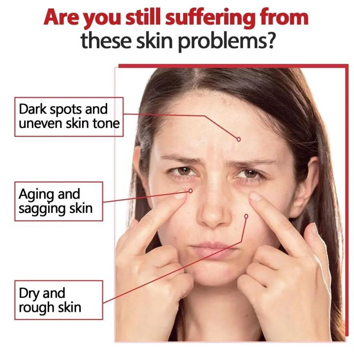 Kojic%20Acid%20Whitening%20Cream%20Skin%20Brightening%20Anti%20Aging%20Remove%20Melanin%20Fade%20Dark%20Spot%20Moisturizing%20Skin%20Care%20Face%20Cream%20for%20Women%20-%20Image%203