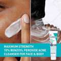 CeraVe Acne Foaming Cream Cleanser 150ml 2025. 